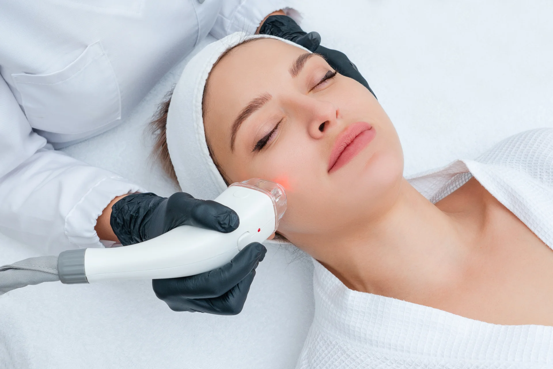 Laser Acne Treatment in Newport Beach, CA | Pacific Obstetrics and Gynecology