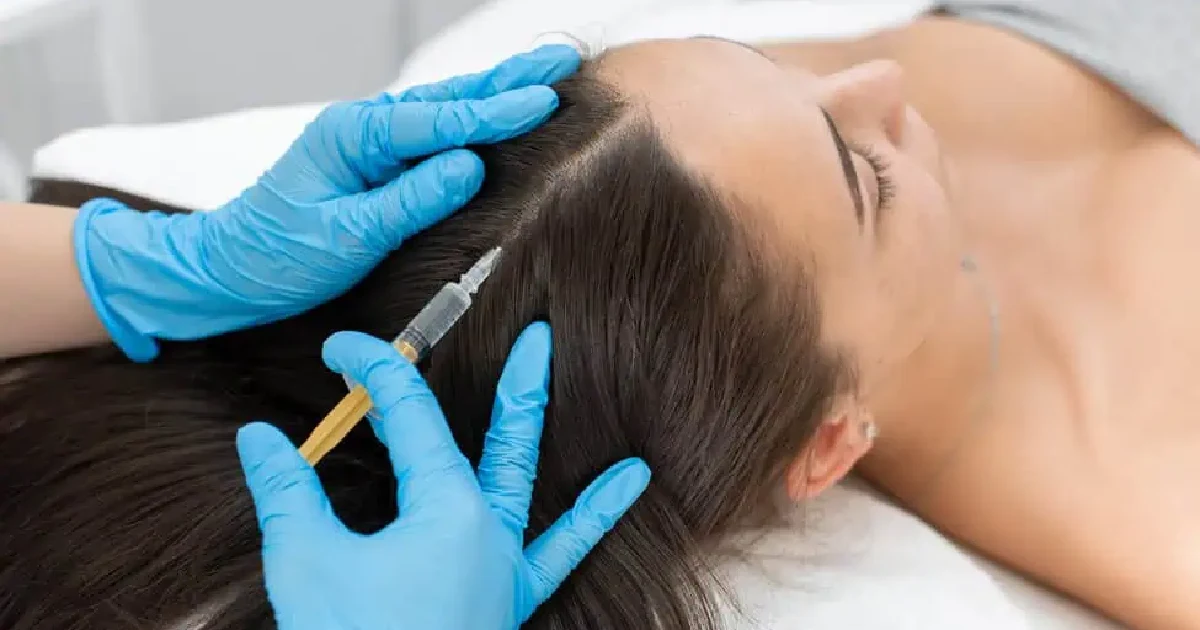 Women Taking Hair Restoration Treatment in Newport Beach, CA