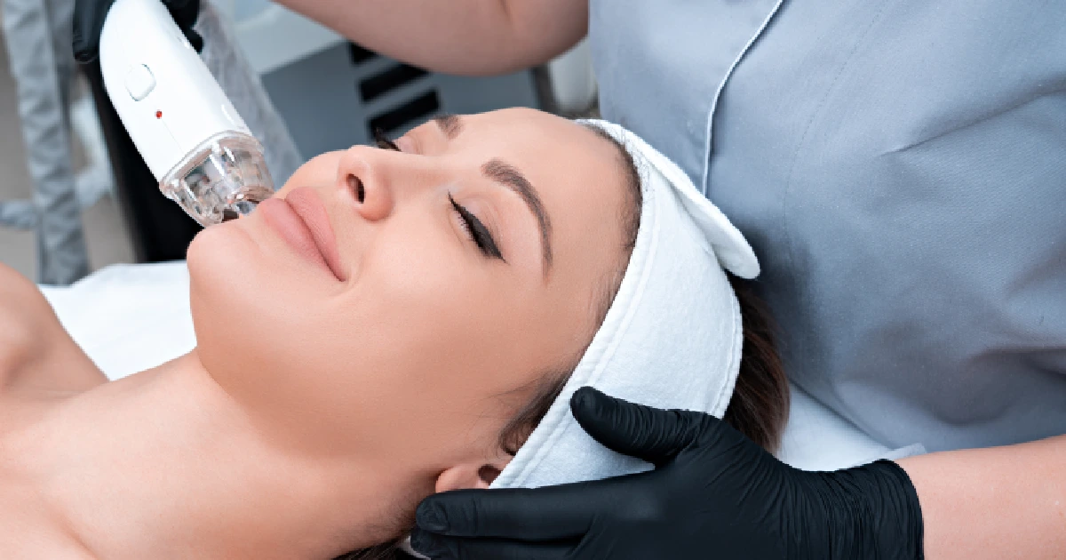 Women receiving in Laser Acne Treatment in Newport Beach, CA