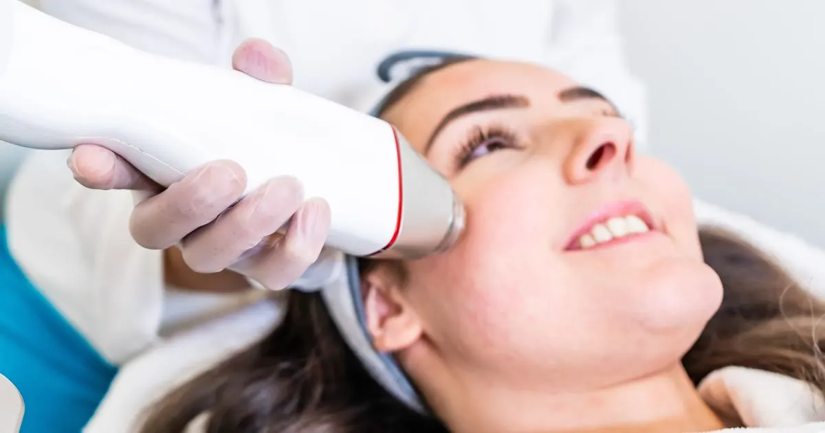 performing RF Microneedling treatment on a woman's cheek area for skin rejuvenation.